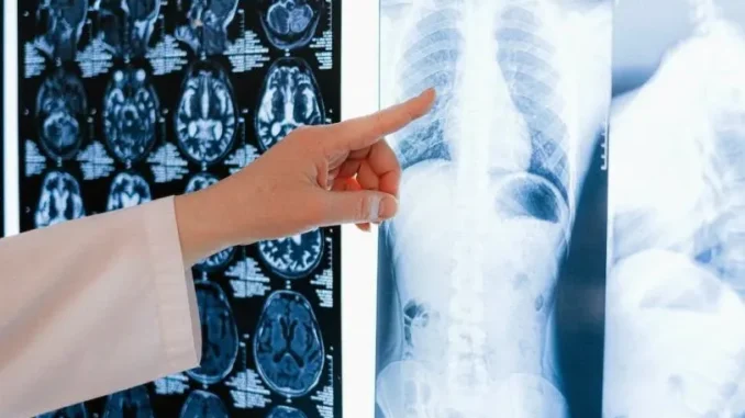 1725305771-pexels-photo-4226124-690x480