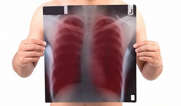 pluca-freepik-620x364