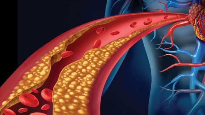 1766335635-holesterol-872x610-690x480