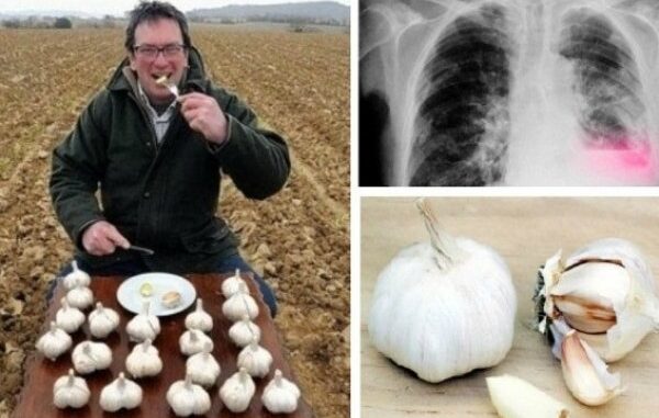 bijeli-luk-prazan-stomak