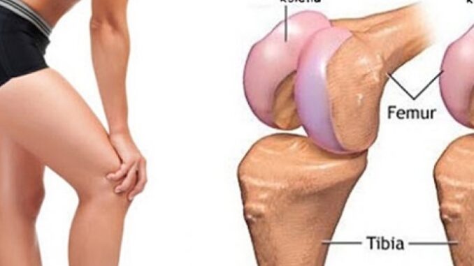 kako-obnoviti-hrskavicu-kolena